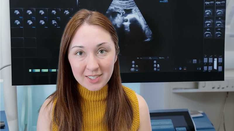 Alex Dainis in front of an ultrasound of a baby